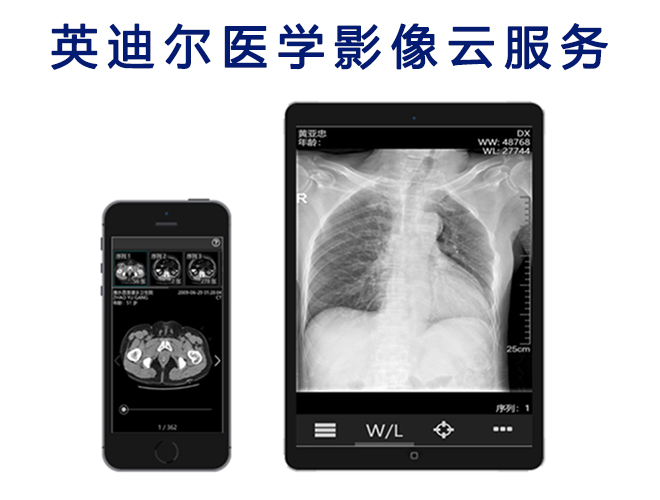 Ӣ�϶���Ӱ��